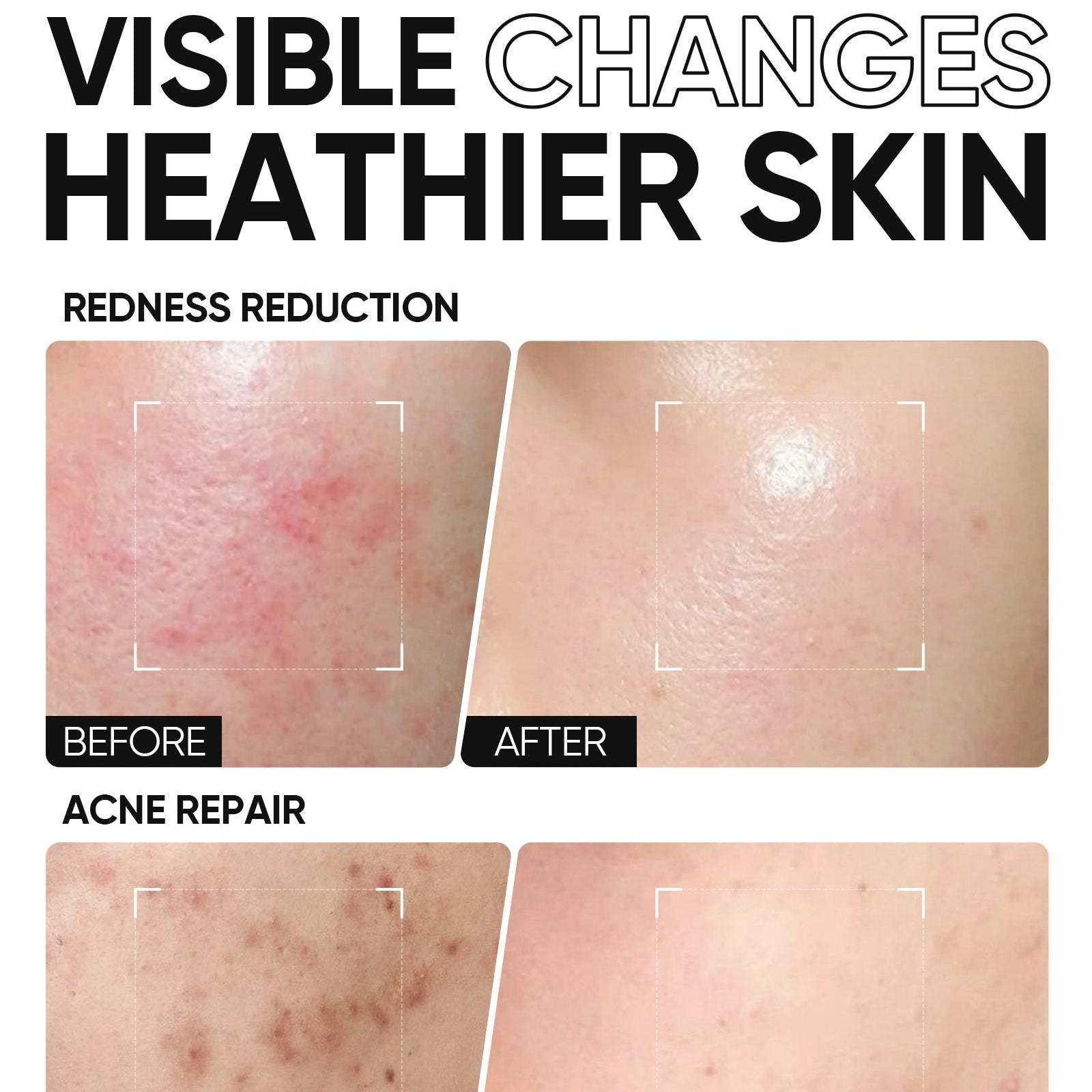 Gel Hydratant Renforçateur à 5X Céramides