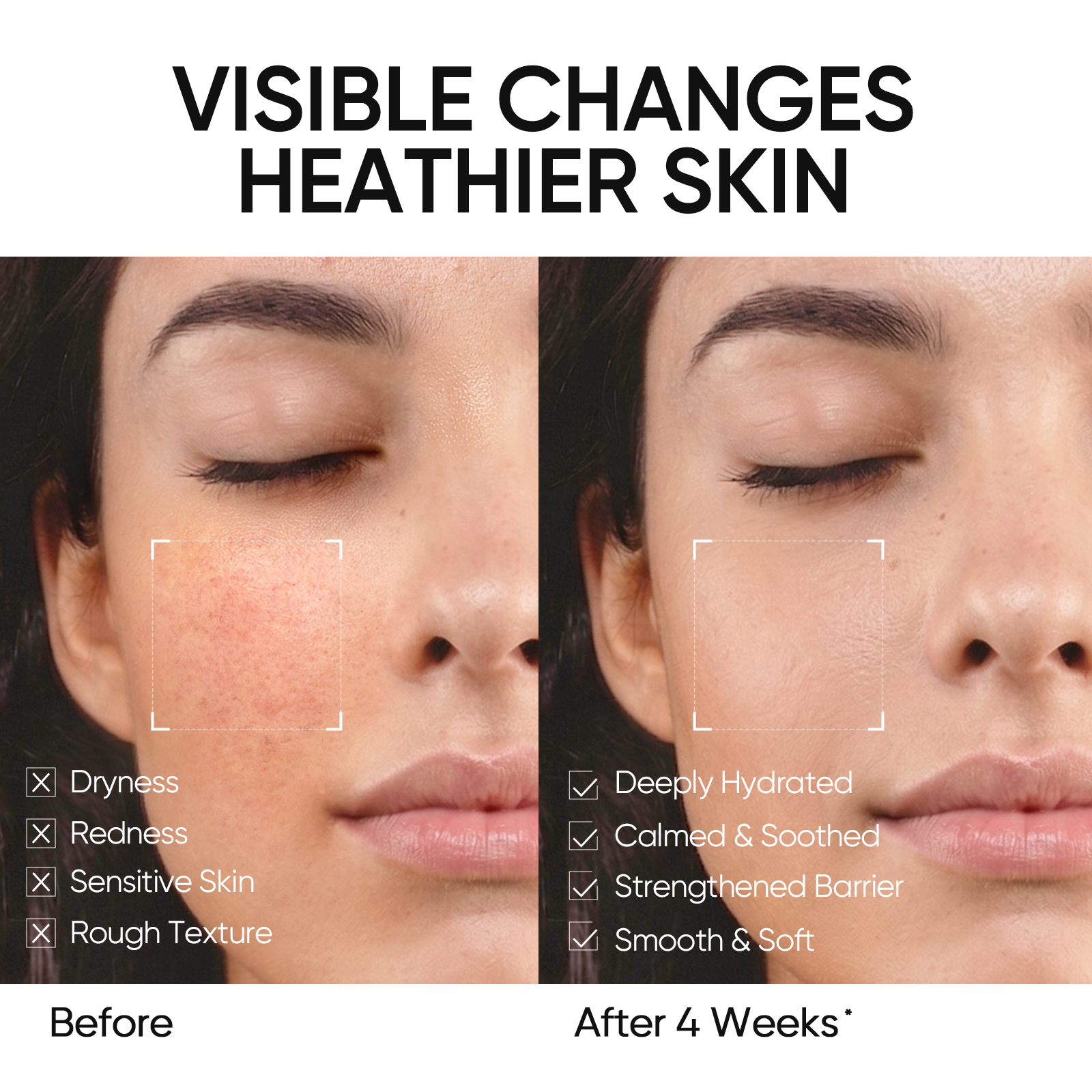 Ensemble Hydratant 5X Céramide & Écran Solaire SPF50
