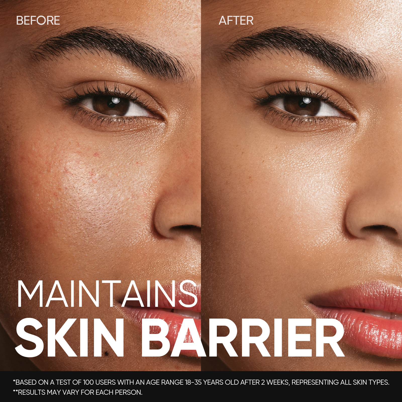 Lotion Tonique Apaisante aux 5X Céramides