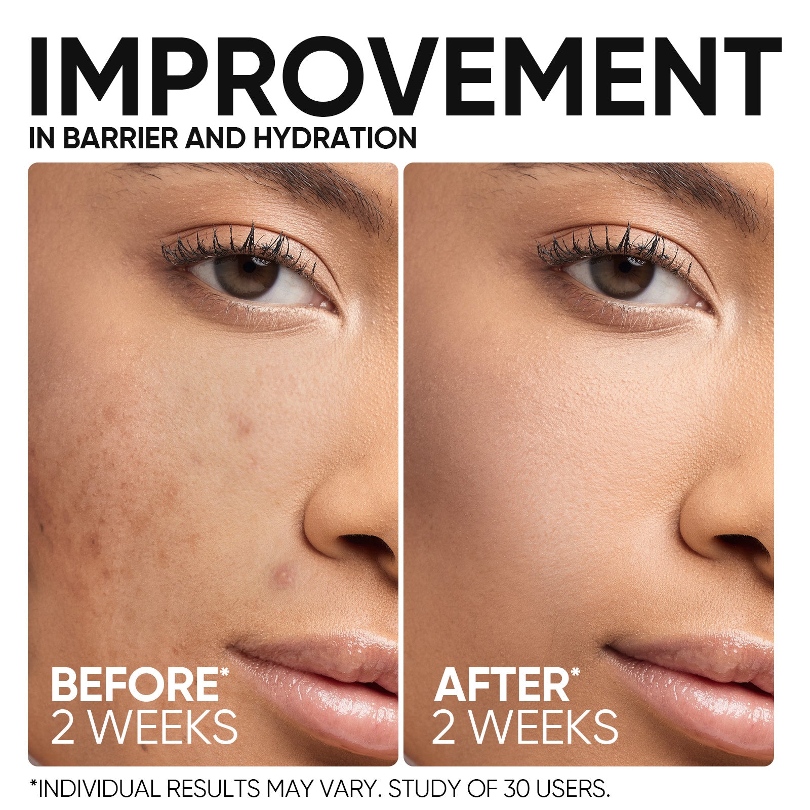 Sérume Barrière 5X Céramides