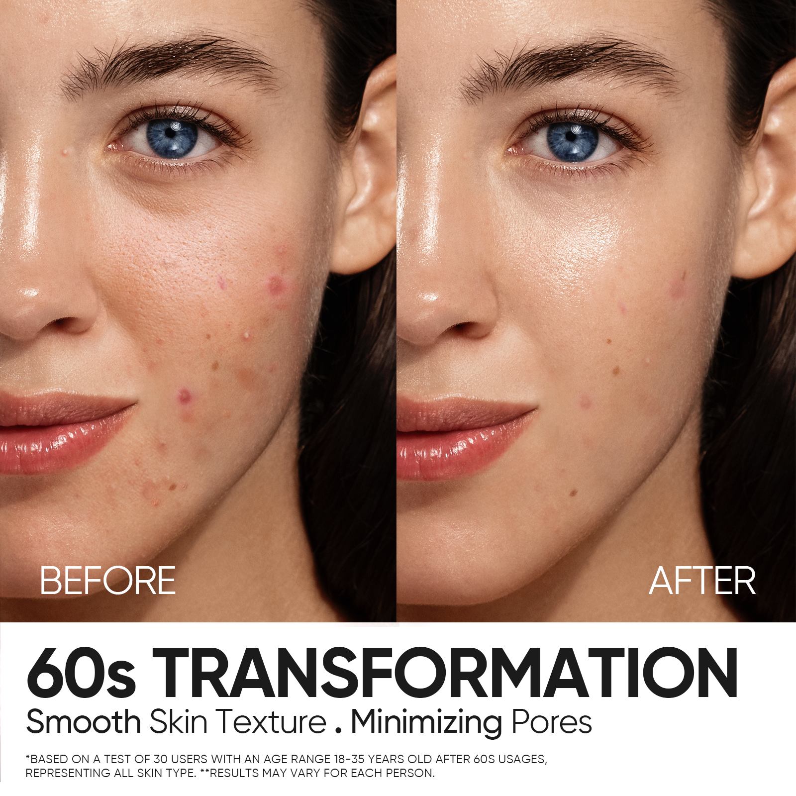 Solution de Peeling 12% AHA BHA PHA LHA