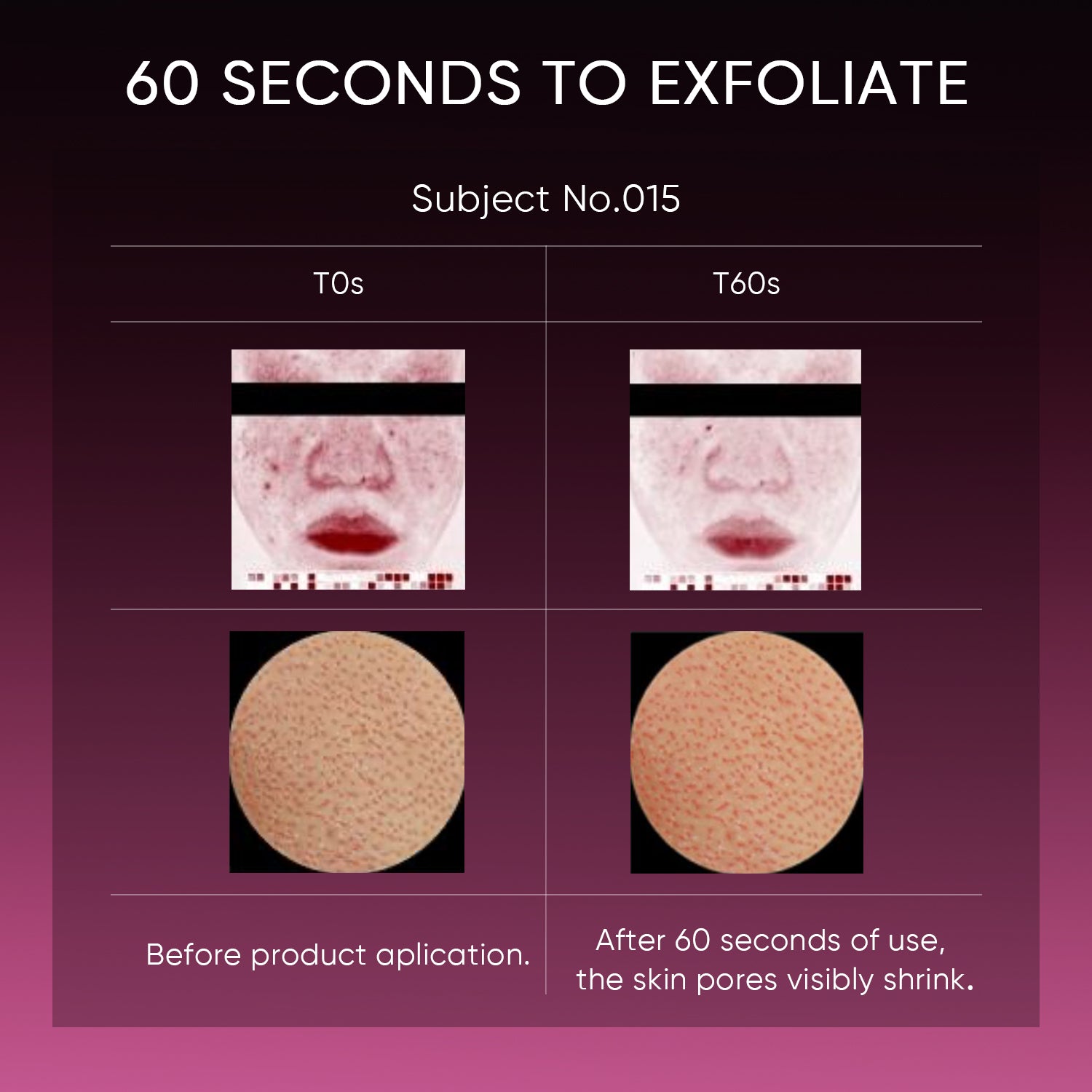 Solution de Peeling 12% AHA BHA PHA LHA