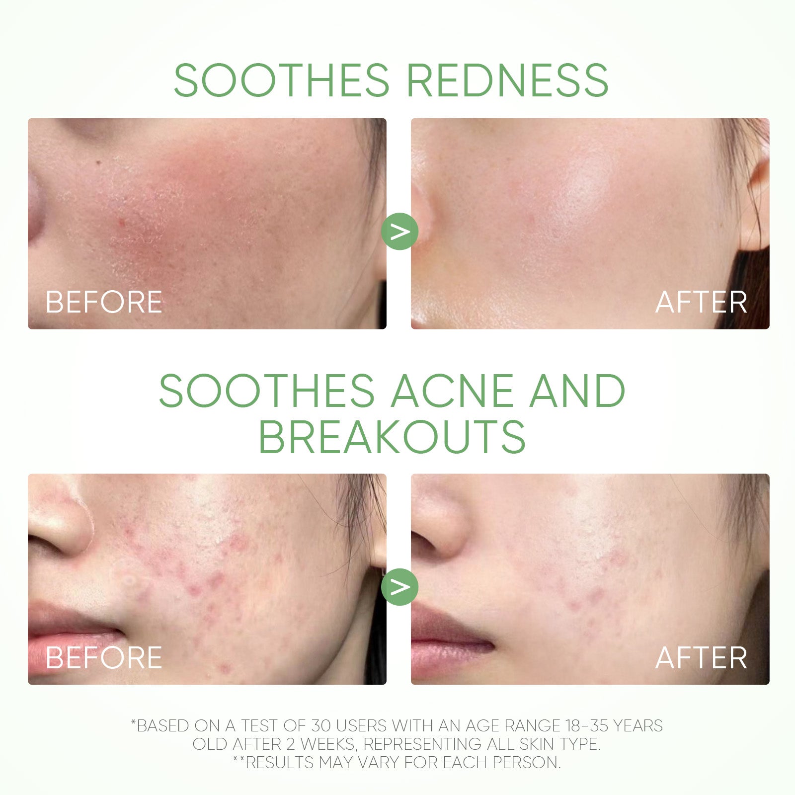 Stick Purifiant Anti-Acné à l’Armoise (Mugwort)