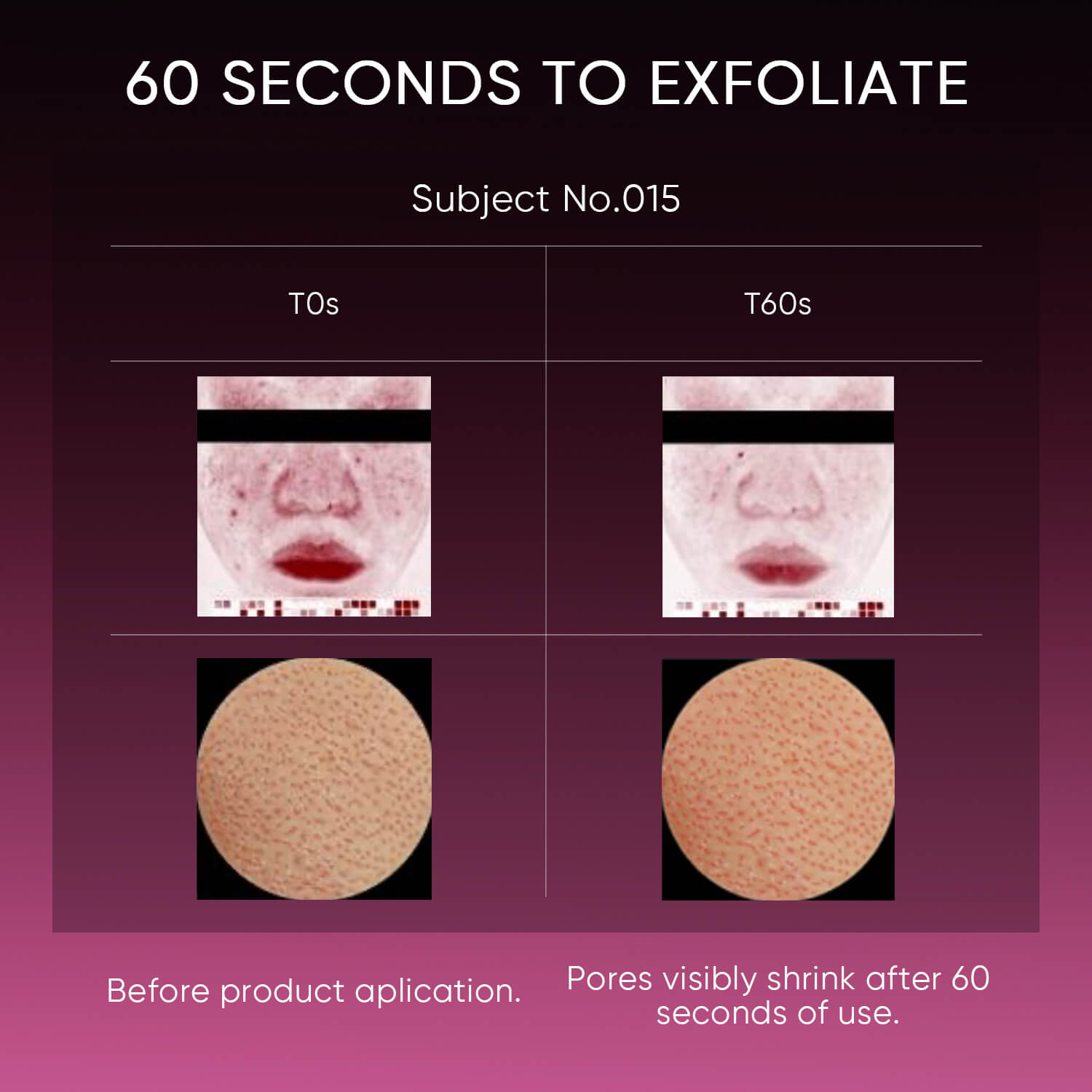 Solution de Peeling 12% AHA BHA PHA LHA