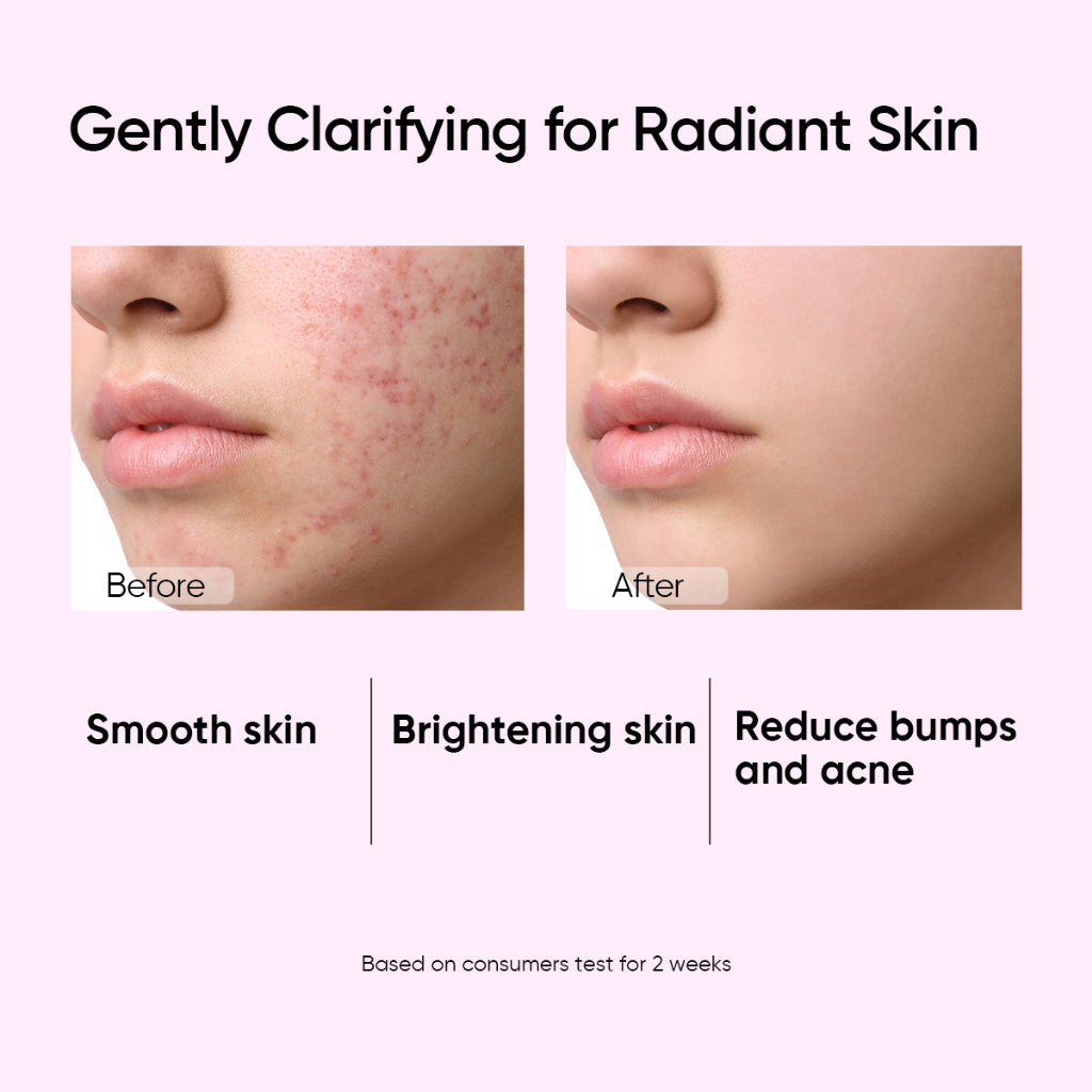 Lotion Tonique Clarifiante Quotidienne à l’Acide Glycolique