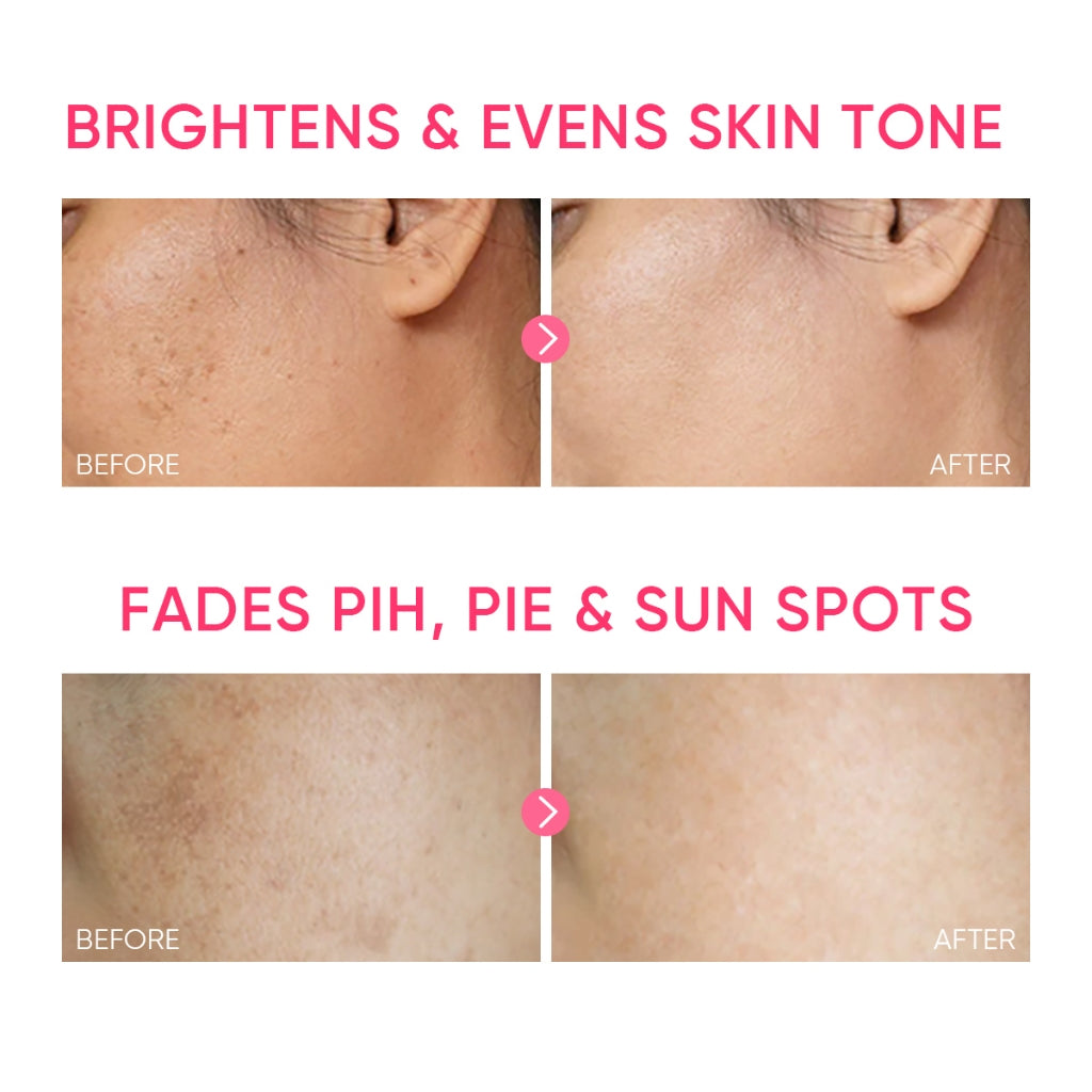 Gel Hydratant Éclat MSH à la Niacinamide