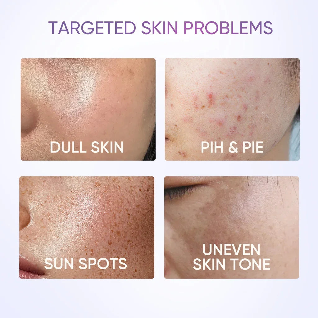 Gel Hydratant Anti-Taches SymWhite 377