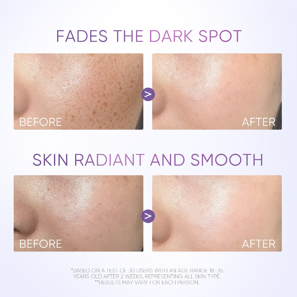 Sérum Anti-Taches Éclat au SymWhite 377