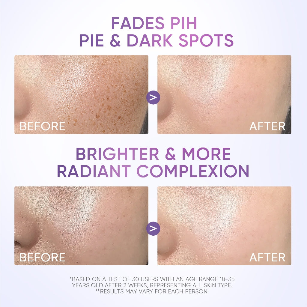 Gel Hydratant Anti-Taches SymWhite 377