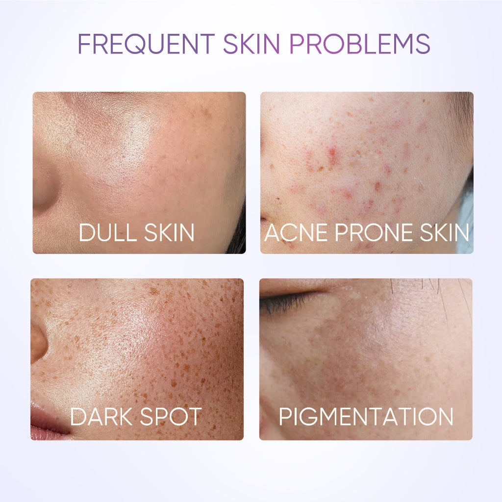 Sérum Anti-Taches Éclat au SymWhite 377