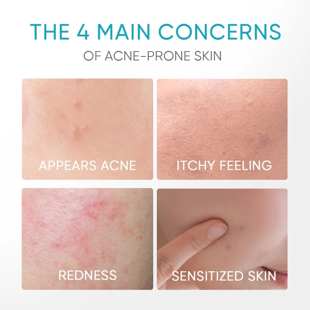 Gel Hydratant Apaisant à 5 % de Panthénol