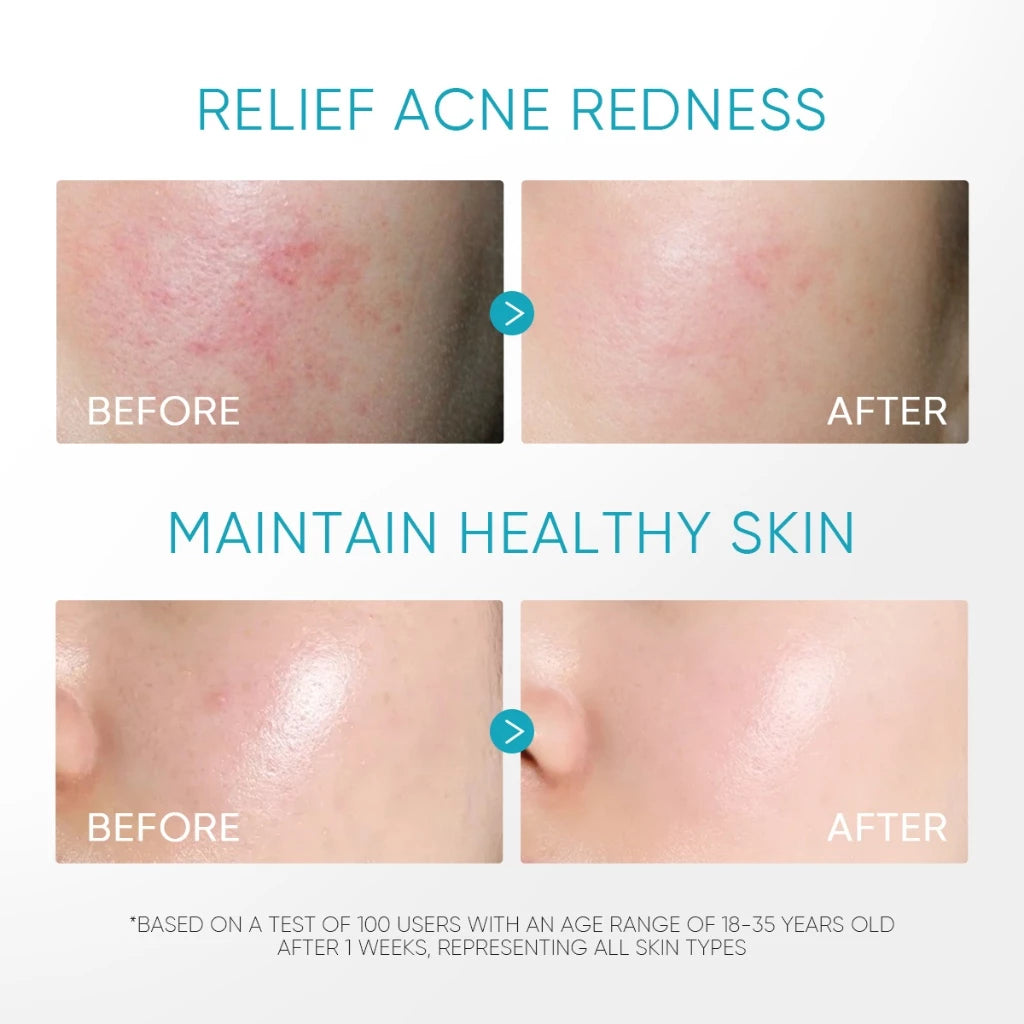 Gel Hydratant Apaisant à 5 % de Panthénol