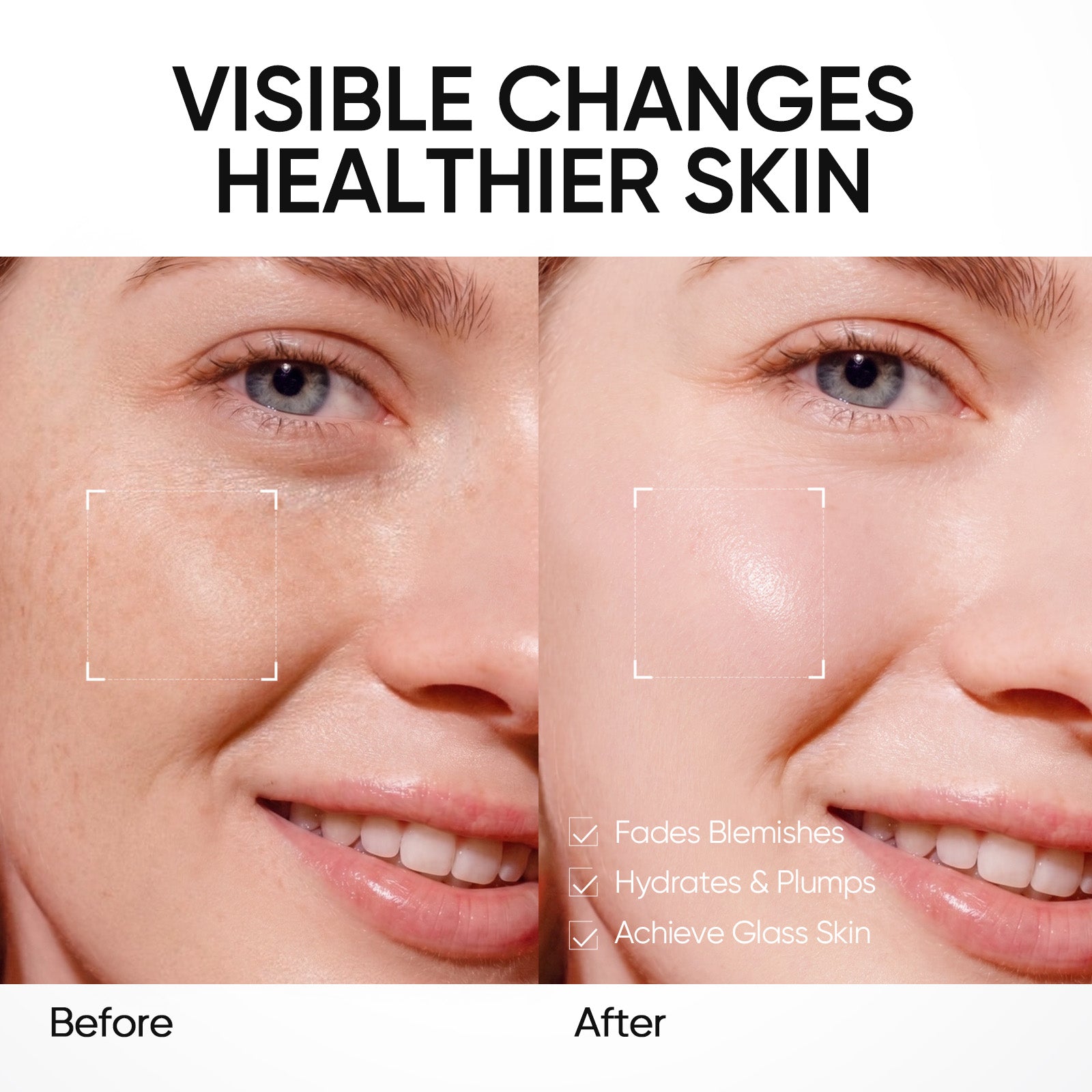 Crème hydratante gel PDRN Éclat et douceur