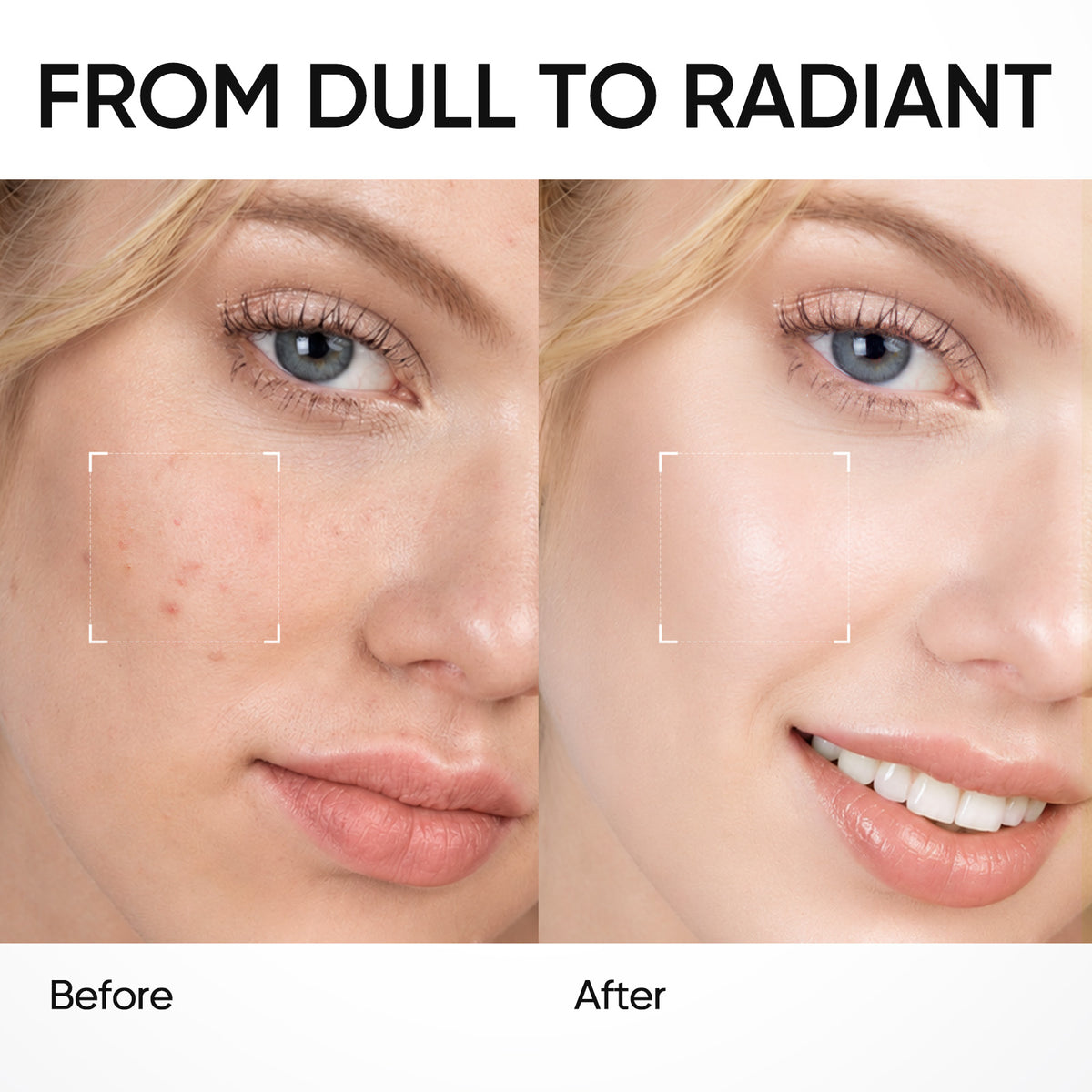 Coffret Niacinamide Glow Reset et Soin Éclat 3 pièces