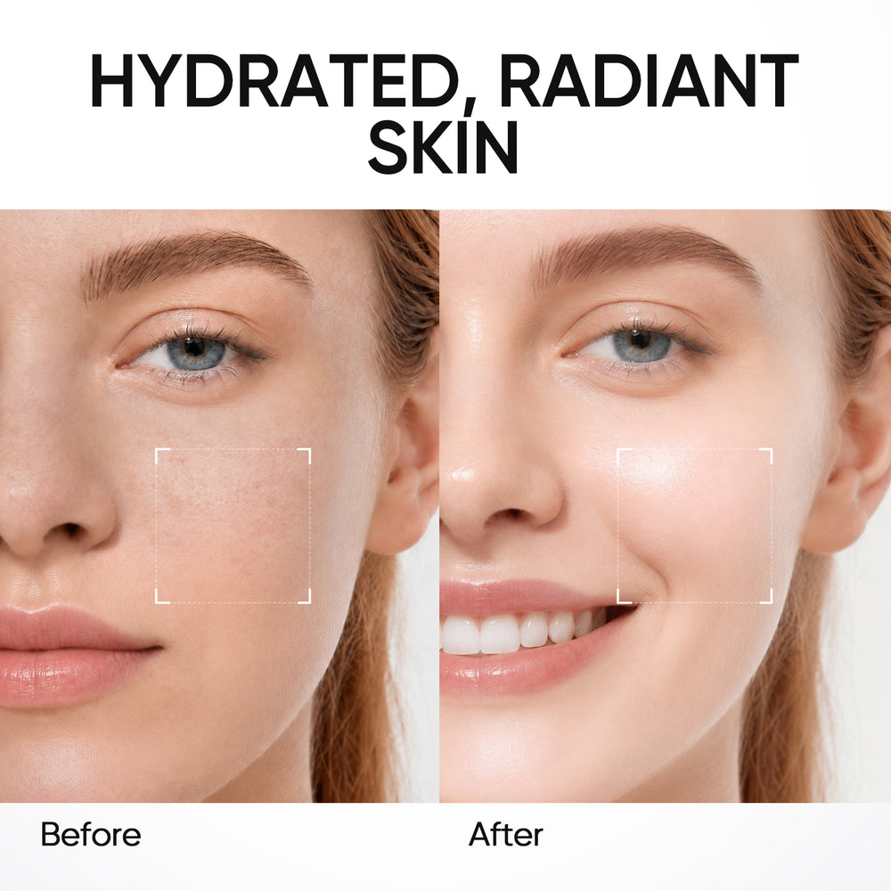 Lotion Tonique Éclaircissante Niacinamide