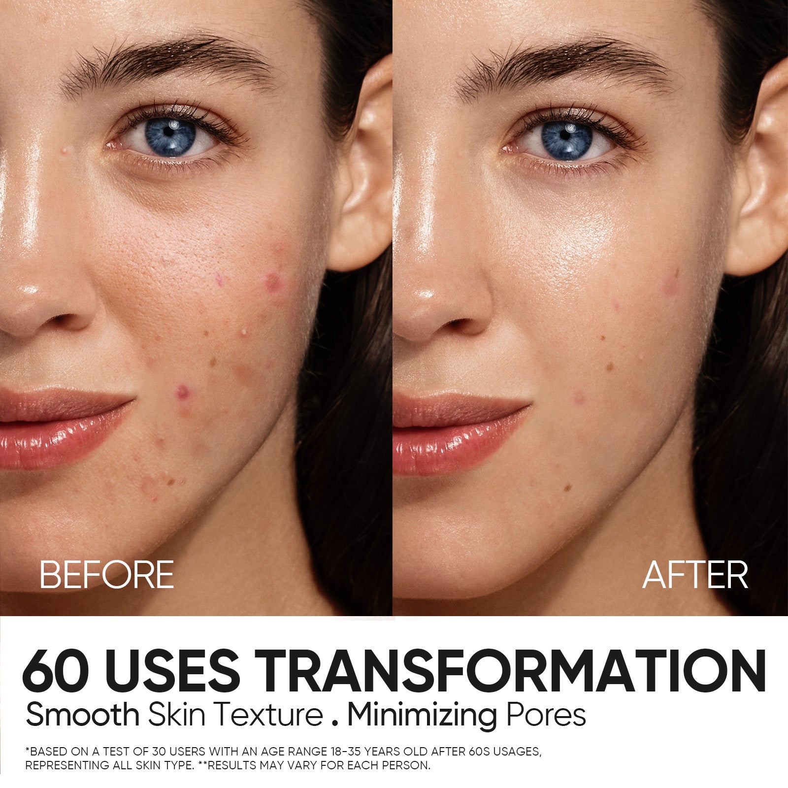 Solution de Peeling 12% AHA BHA PHA LHA