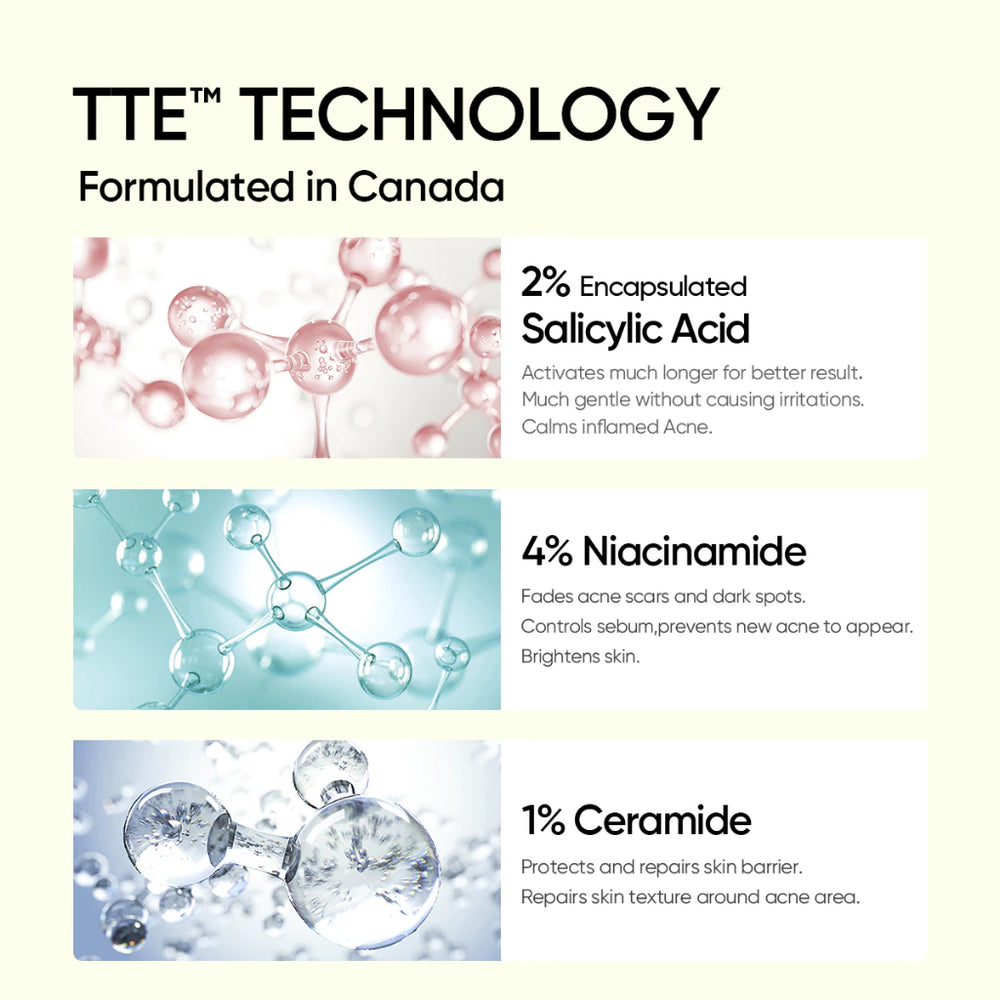 2% Salicylic Acid Serum Acne Treatment & Pore Clearing